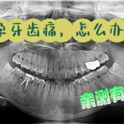 孕期能种牙吗（孕期能种牙吗）