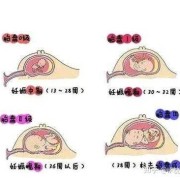 孕妇羊水多怎么办,胎儿羊水过多怎么办,34周60mm
