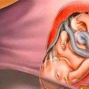 孕晚期胎儿突然不动了（孕晚期胎儿突然不动了）