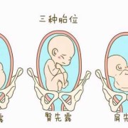 胎儿在子宫里的姿势图（胎儿在子宫里的姿势图片）