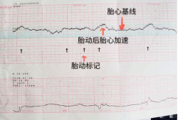 胎儿的心率是多少正常范围,胎儿心博是妊娠第几周
