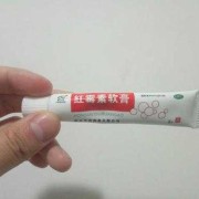 孕期能用红霉素软膏吗（孕期能用红霉素软膏吗会流产吗）