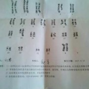 胎儿染色体病（染色体异常怎么办）