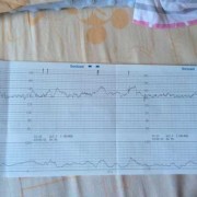 胎儿的心跳一分钟多少（怀孕13周胎儿心律167/一分钟，正常吗）