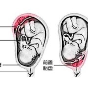 怀孕胎儿位于在前壁和后壁有什么区别吗,胎儿在前壁是男是女