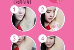 孕妇生产前要刮阴毛吗,怀孕了可以剃毛刀脱毛吗