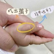 19个月宝宝习惯吃手指，要怎样纠正啊，经常把手指给吮破了,吃胎儿事件是真的吗