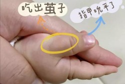 19个月宝宝习惯吃手指，要怎样纠正啊，经常把手指给吮破了,吃胎儿事件是真的吗