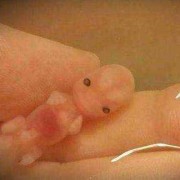 胎儿眼睛小（胎儿眼睛小的原因）