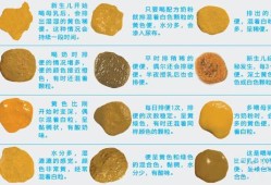 胎儿的胎粪怎么排出，用什么方法好呢,胎儿的粪便在母体内排哪
