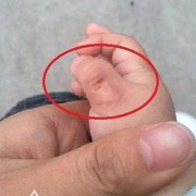 胎儿吃手（三个月宝宝醒了就吃手，应该怎么办呢）