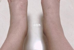 孕期脚凉怎么回事（孕期脚凉是什么原因怎么办）