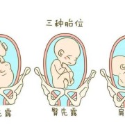 左骶横位胎儿图片（左骶横位胎儿图片）