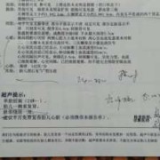 胎儿右肾（胎儿如果是重复肾有什么后果）
