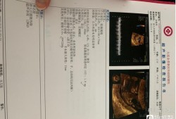 胎儿膀胱未显示是怎么事,胎儿膀胱大小正常值