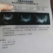 怀孕六十天胎儿有多大（怀孕60天感觉肚子大了是正常的么？按时做好检查，胎儿长大了吗）