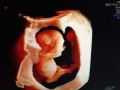 怀孕11周胎儿多大（怀孕11周了头臀径大概多少是正常的）
