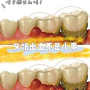 孕期牙龈出血是怎么回事（孕期牙龈出血是怎么回事儿）