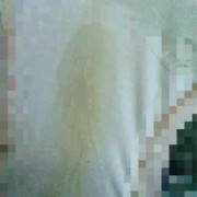 孕期白带发黄无异味