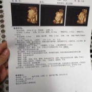 胎儿偏大有什么影响（怀孕32周检查胎儿偏大3周正常吗）