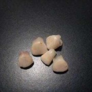 一周胎儿图（宝宝一周八个月了才长了七颗牙，怎么办？跟什么有关系）