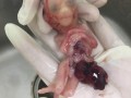 染色体正常胎儿畸形什么原因,胎儿没那么容易畸形孕四个月得了甲流胎儿有影响吗