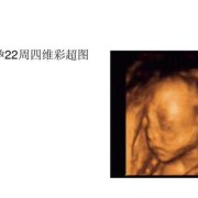 孕22周胎儿在什么位置（孕22周胎儿心率163-146，很不好吗）
