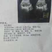 胎儿偏小一个月的危险（胎儿偏小一个月的危险性大吗）