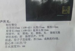 胎儿偏小一个月的危险（胎儿偏小一个月的危险性大吗）