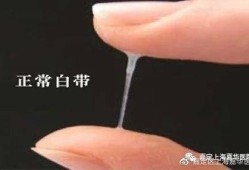 孕期内分泌多怎么回事（孕妇白带多怎么回事）