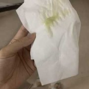 怀孕期间白带多（早期怀孕白带多吗？是怎么样子的症状）