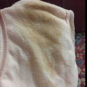 我怀孕以后的内裤上总发黄是怎么回事,孕期内裤总是湿的发黄还有尿臭味