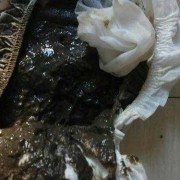 孕妇拉的屎是黑色的，这是怎么回事呢,怀孕期间大便是黑色的正常吗