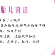胎儿窘迫怎么办（胎儿窘迫怎么办才能治好）