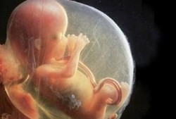 70天宝宝可以趴吗？多大开始锻炼最好呢,怀孕七十天胎儿图片 正常