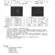 孕妇心脏彩超多少钱,为什么不建议做心脏彩超