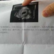 胎儿没胎心原因（胎儿突然没有胎心原因是什么啊？是胎停了吗）