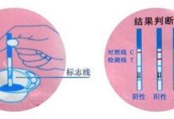 测胎儿孕龄（测胎龄是什么意思）