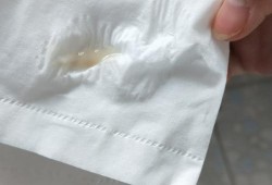 怀孕了还会有白带吗,