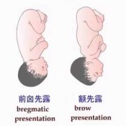 loa是什么的简写,胎儿loa是什么胎位