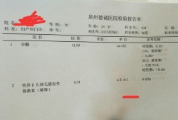 孕期抽血好吗（孕期抽血好吗有影响吗）