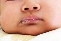 新生儿嘴巴吐泡泡怎么回事,胎儿在肚子里吐泡泡怎么回事