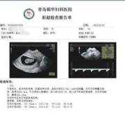 孕妇nf检查是什么意思,胎儿NF是什么意思
