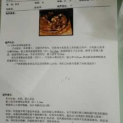 胎儿颈项透明层厚度正常值（胎儿颈项透明层厚度1.3是男孩女孩）
