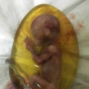 胎儿偏小2周会晚生吗（偏小两周胎儿生下来有没有问题）