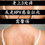 感染了HPV可以要孩子吗,孕期感染hpv怎么办,做什么检查能查出来