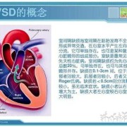 胎儿室间隔膜部缺损（胎儿室间隔膜部缺损自愈率）