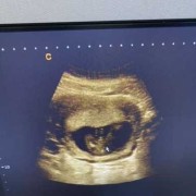 孕16周胎儿发育情况是什么,怀孕16周胎儿彩超图片