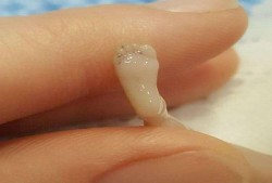 被打掉的胎儿（女朋友怀孕了把孩子打掉怎么办）