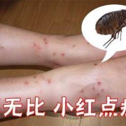 孕期五个月肚子疼（怀孕五个月，肚皮上长很多小红点，特别痒该怎么办）